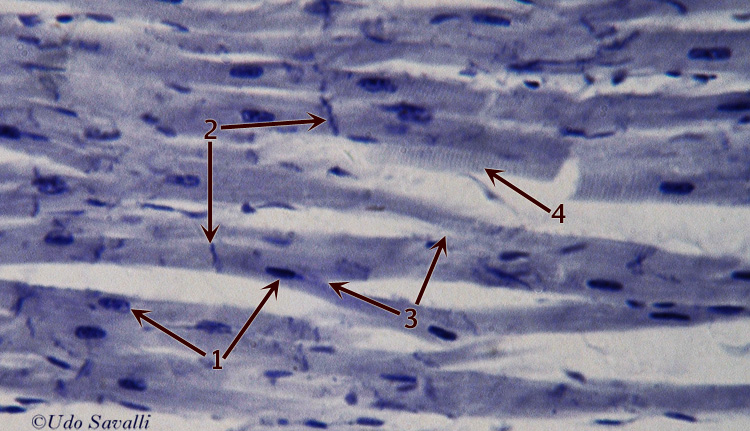 Cardiac Muscle