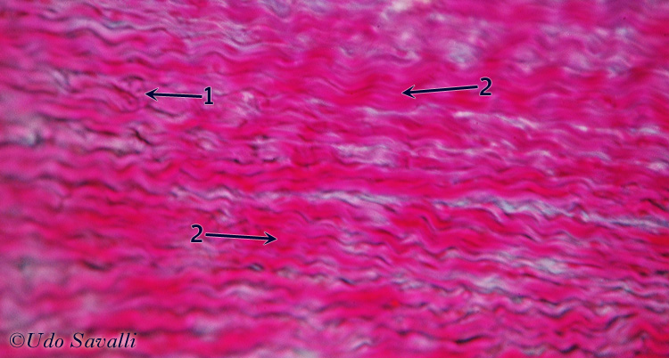 Fibrocartilage