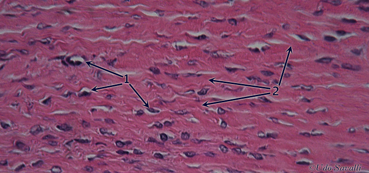 Fibrocartilage