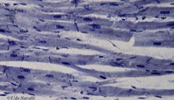 muscle tissue