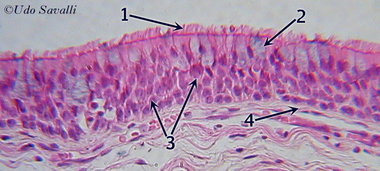 pseudostratified columnar