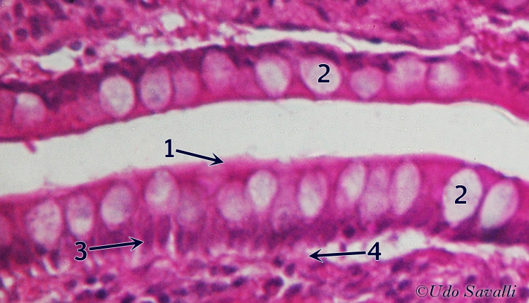 simple Columnar epith