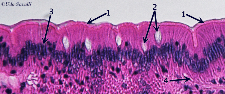 simple Columnar epith