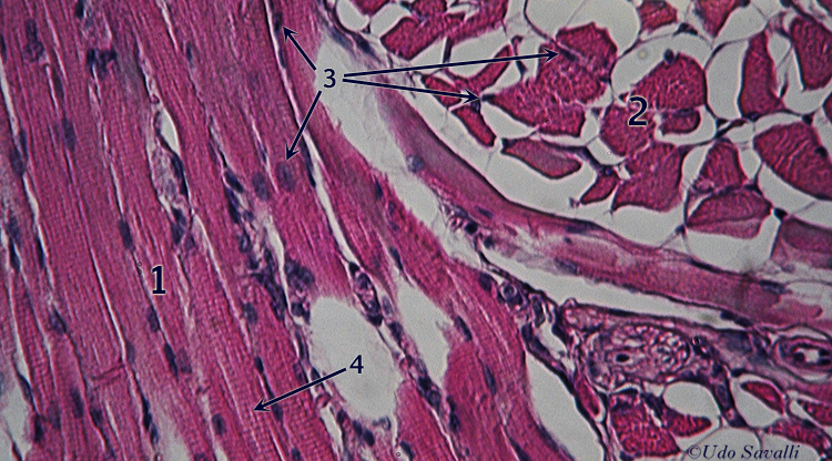 skeletal muscle