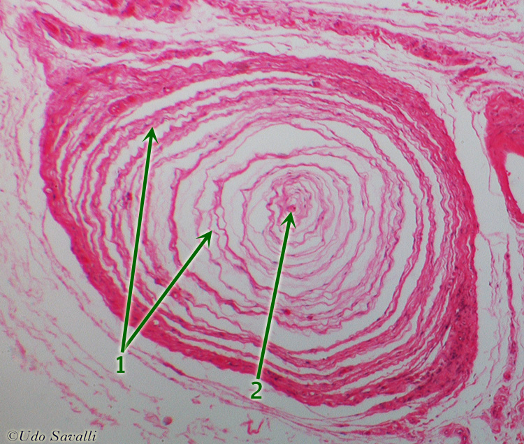 Lamellated corpuscle