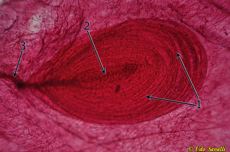 Lamellated corpuscle