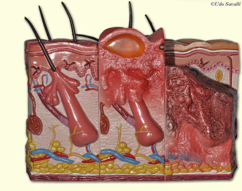 Skin model unlabeled