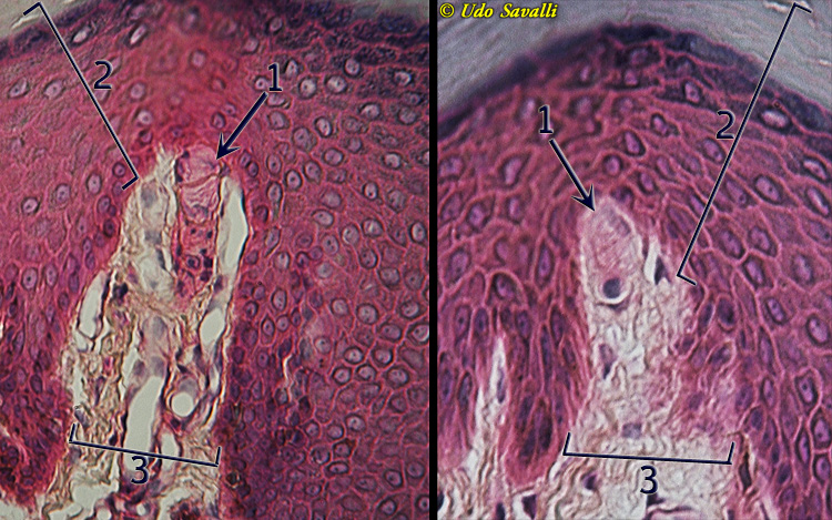 tactile corpuscles