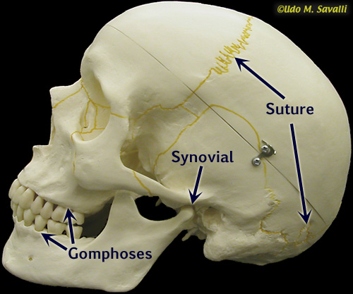 skull labeled