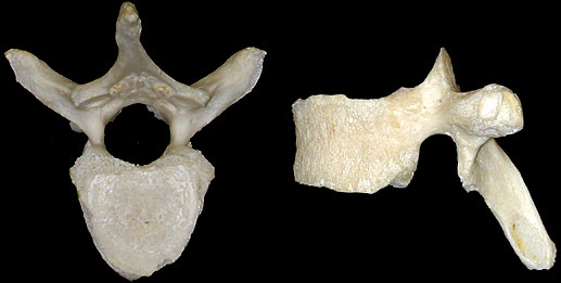 vertebra A