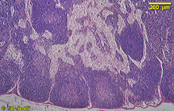 lymph node