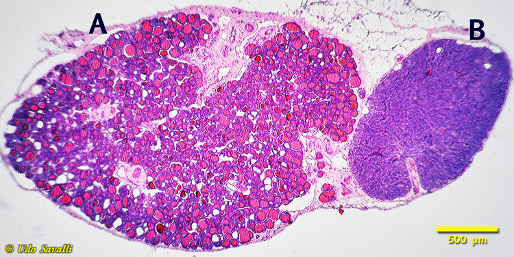 Thyroid/Parathyroid Histology