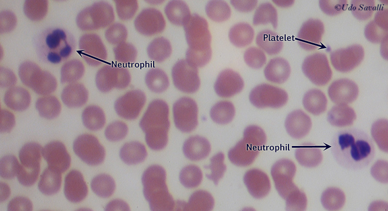 Blood Smear