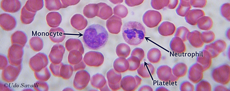 Blood Smear