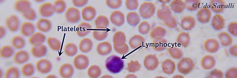 Blood Smear