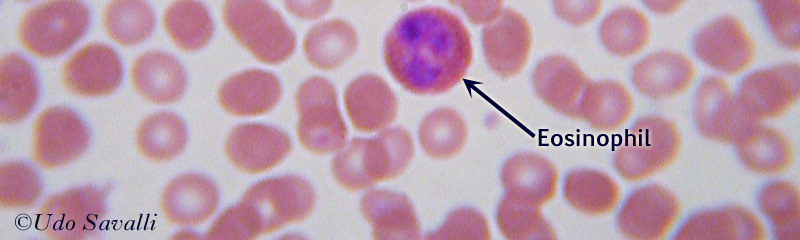 Blood Smear