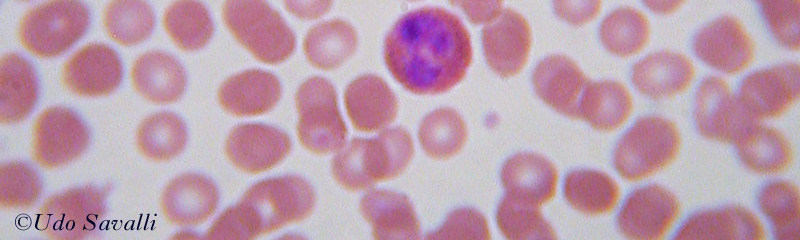 Blood Smear