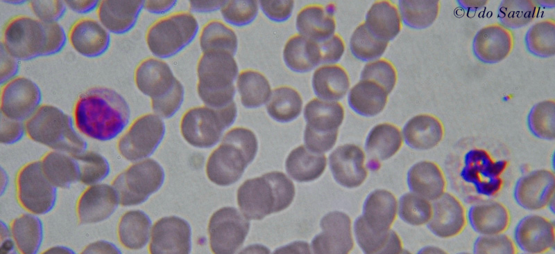 Blood Smear