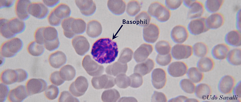 Blood Smear