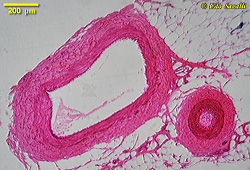 artery & vein slide