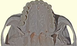 Teeth id