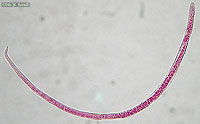 Trichina worm
